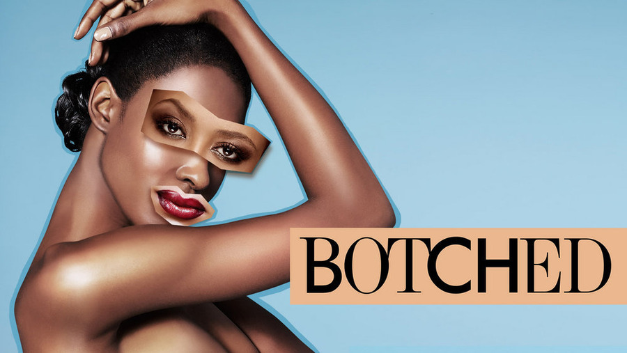 E! Renews ‘Botched’ For Season 4