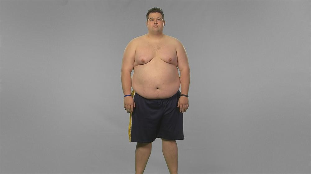 Extreme Weight Loss: David's Inspiring Journey