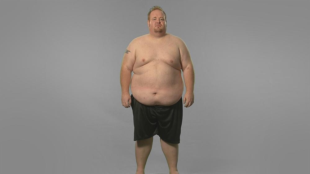 Extreme Weight Loss: Jayce's Journey