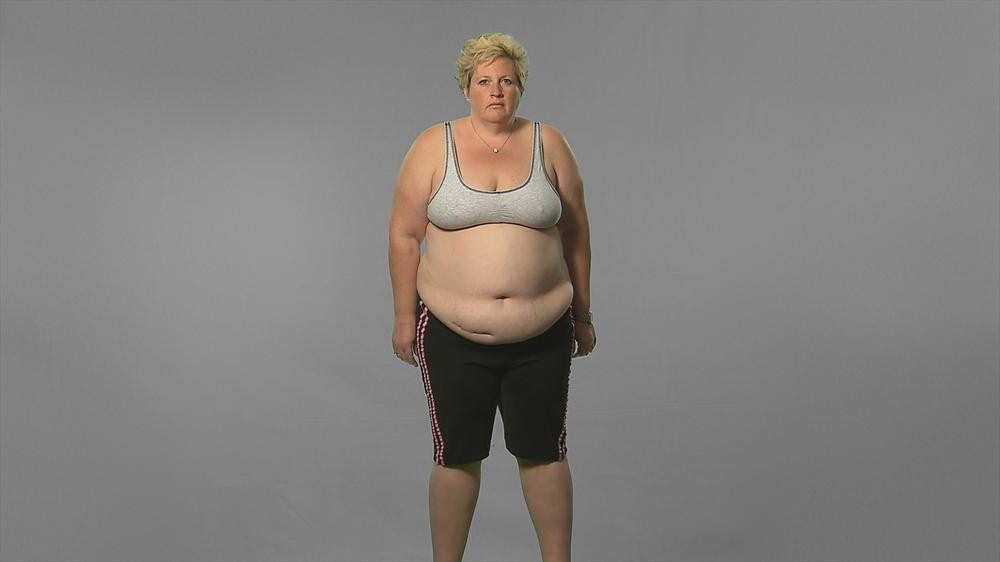 Extreme Weight Loss: Melissa